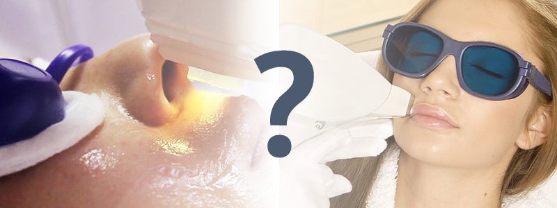 Что лучше: лазерная эпиляция или фотоэпиляция