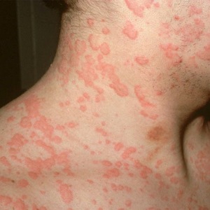 Крем Фунготербин от грибка ногтей