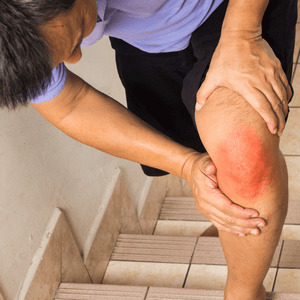 Полезна ли ходьба на коленях при артрозе