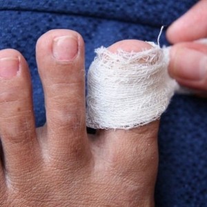 Лечение грибка ногтей на ногах хозяйственным мылом