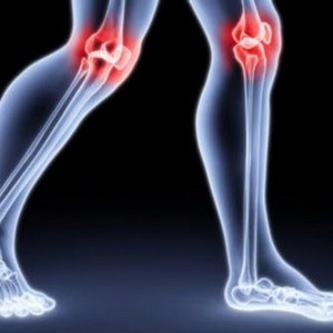 Как избавиться от хруста в коленях