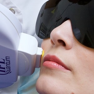 Что лучше: IPL или RF эпиляция