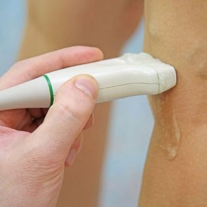 Как лечить кисту Бейкера под коленом