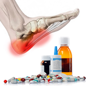 Как лечить шпоры на пятках народными средствами