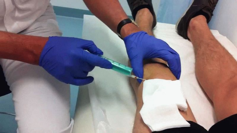 Как лечить ушиб колена в домашних условиях