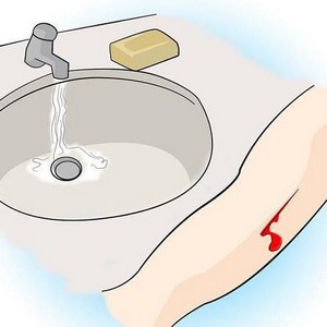 Порезы после бритья: как остановить кровь на ногах и в интимной зоне