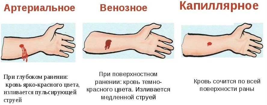 Порезы после бритья: как остановить кровь на ногах и в интимной зоне