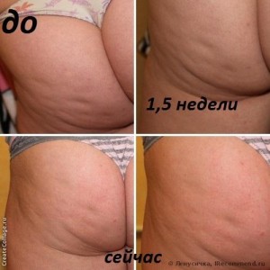 Как сделать кофейный скраб от целлюлита