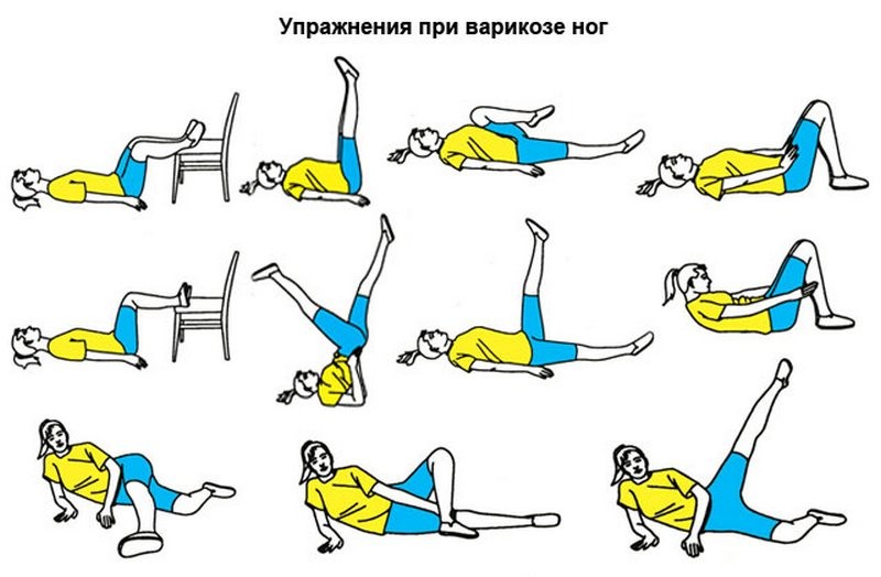 Слабые сосуды на ногах при варикозе: как можно укрепить вены и сосуды