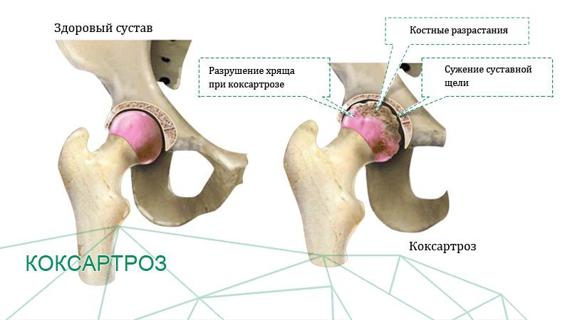 Как устроена седалищная кость
