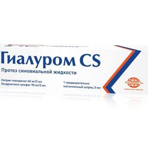 Как восстановить хрящевую ткань коленного сустава