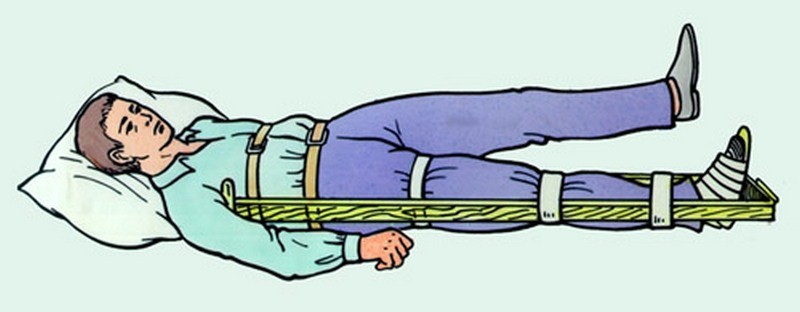 Как вправить тазобедренный сустав