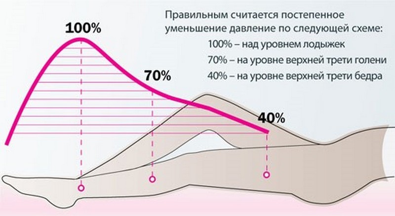 Как выбирать компрессионные чулки для операции