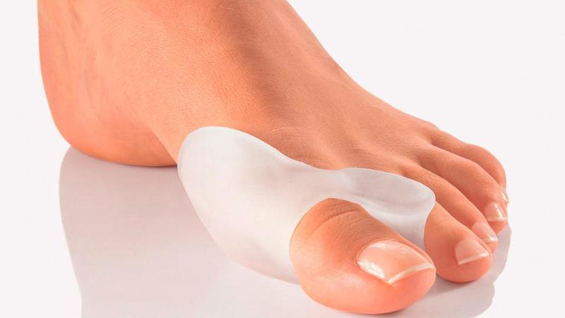 Как выбрать вальгусную шину для косточки