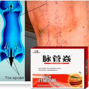 Товары от варикоза из Китая: мазь и пластырь - отзывы о применении