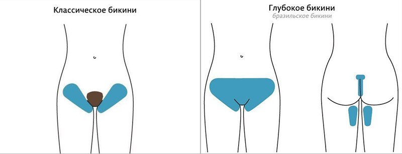 Как делается шугаринг зоны классического бикини