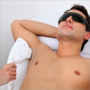 Мужская лазерная эпиляция