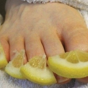 Лимон против грибка ногтей на ногах