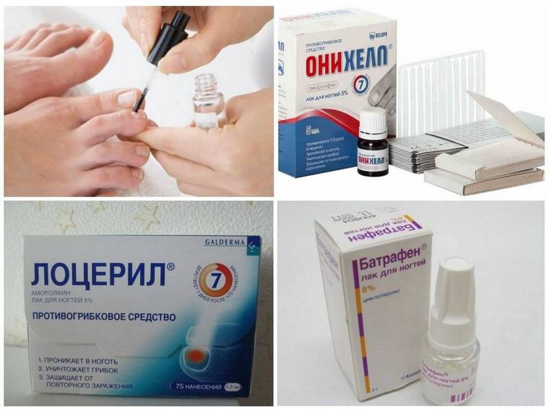 Методы лечения грибка ногтей на ногах