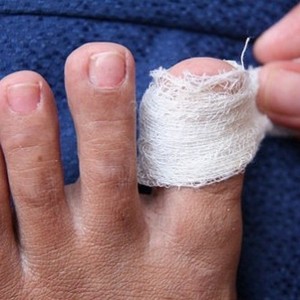 Уксус от грибка ногтей на ногах - средство от самого Гиппократа