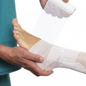 Как лечить синовит голеностопного сустава