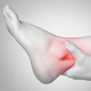 Как лечить синовит голеностопного сустава