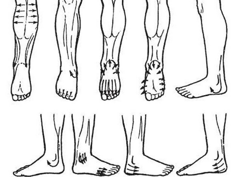 Техника лимфодренажного массажа ног