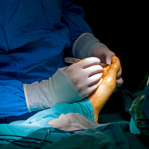 Как лечат лошадиную стопу