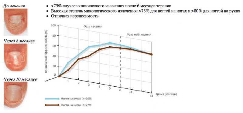 Инструкция по применению лака Лоцерил от грибка ногтей