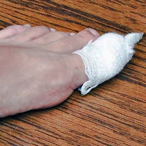 Масло чистотела от грибка ногтей: инструкция по применению