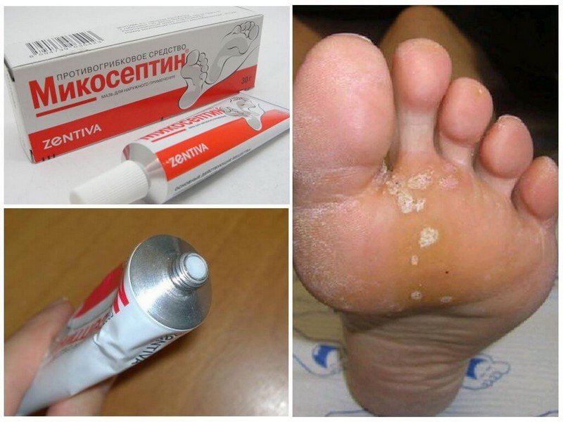 Микосептин: инструкция по применению