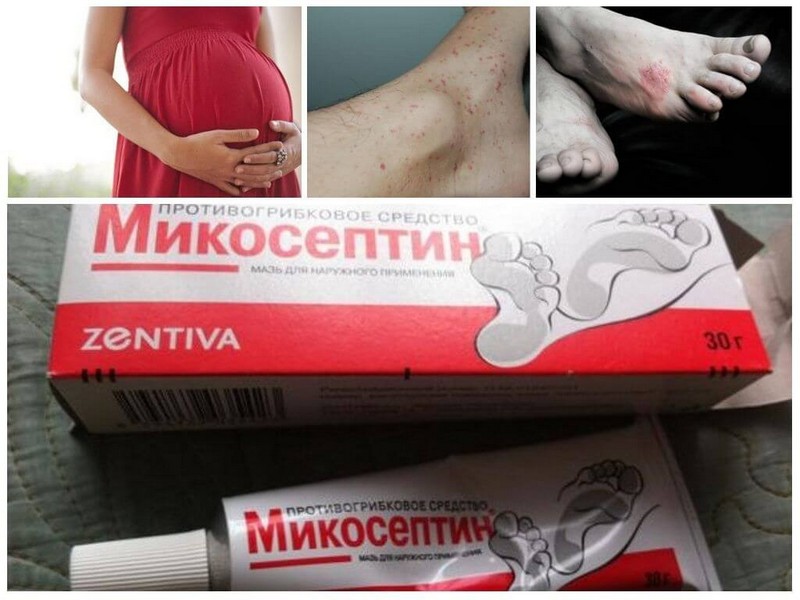 Микосептин: инструкция по применению