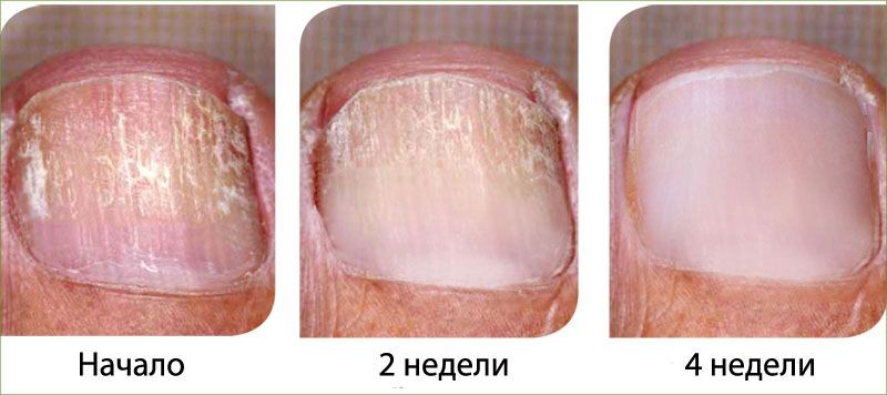 Инструкция по применению Mei Yan Qiong против грибка