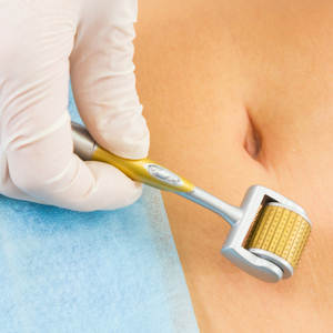 Действие мезороллера от растяжек на теле и целлюлита