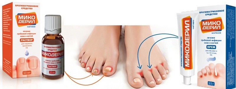 Инструкция по применению раствора Микодерил при грибке ногтей