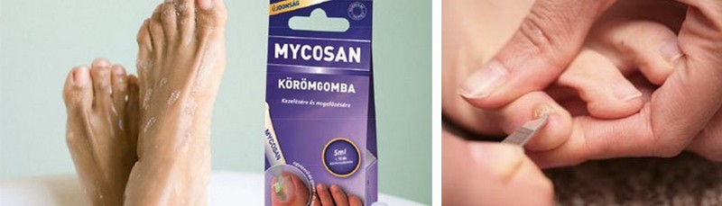 Препарат Микозан от грибка: подробная инструкция по применению