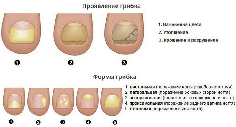 Гель Мизол - инструкция по применению
