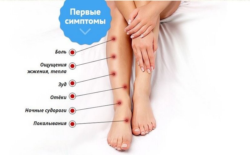 Велосипед и варикоз: можно ли кататься при варикозном расширении вен