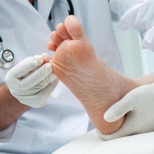 Как применять Нафтифин от грибка ногтей