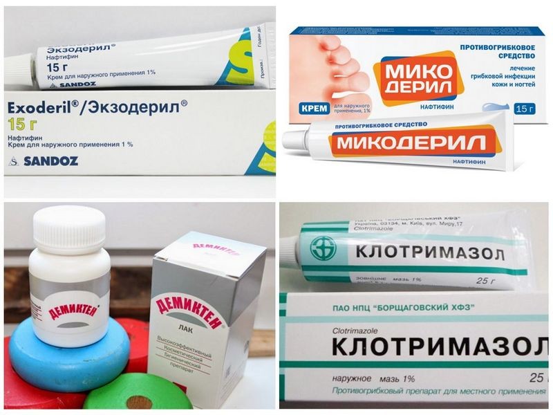 Как применять Нафтифин от грибка ногтей