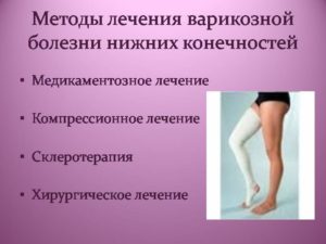 как вылечить вены на ногах народными средствами