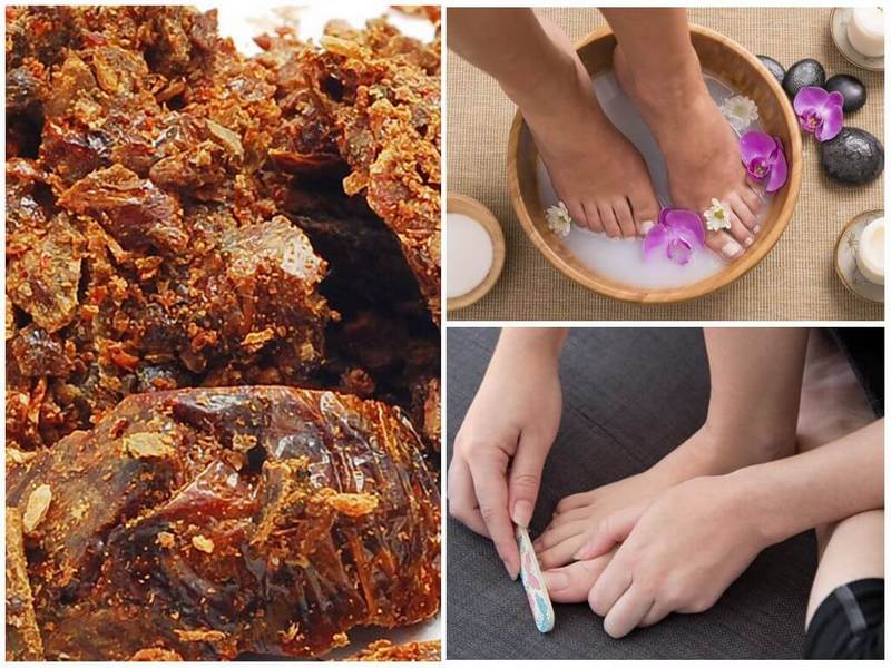 Прополис для лечения грибка ногтей ног