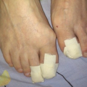 Ногтивит усиленный: инструкция по применению