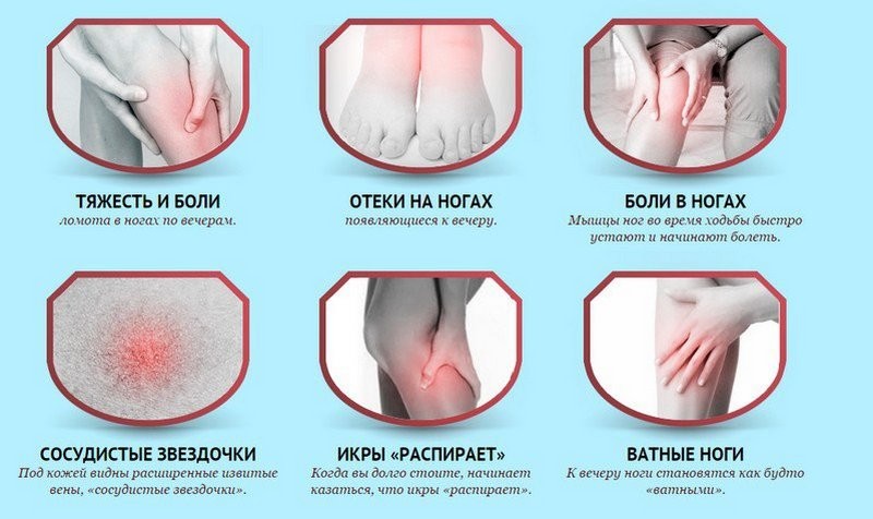 Возможные осложнения при варикозе вен нижних конечностей