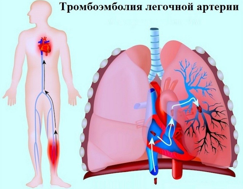 Отзывы пациетов об операциях лазером при варикозе
