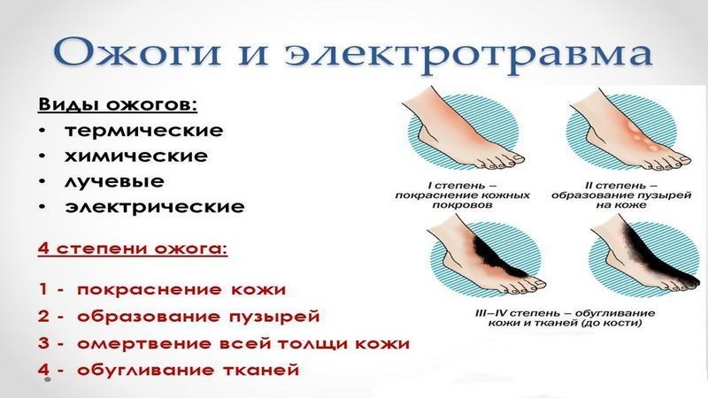 Что делать с ожогами после лазерной эпиляции