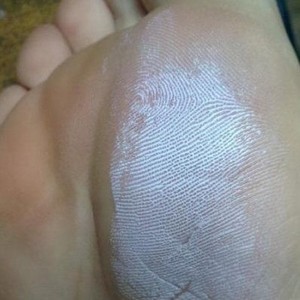 Как применять Пасту Теймурова от грибка ногтей