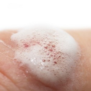 Как вылечить грибок ногтей перекисью водорода