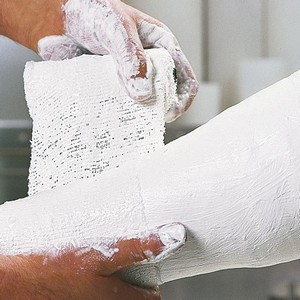 Как лечить перелом коленного сустава