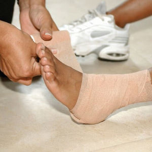 Как лечить перелом стопы